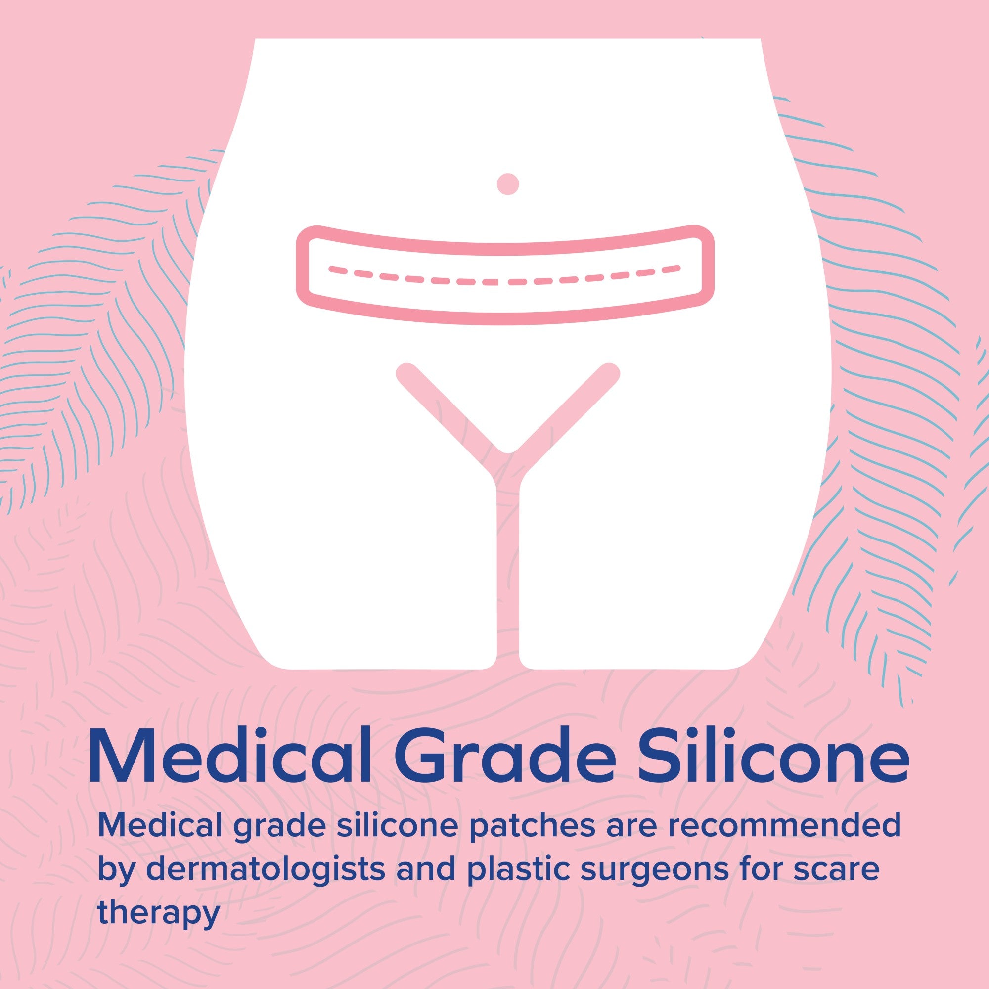 Stretch Mark & C-Section Scar Strips (6 Pack)